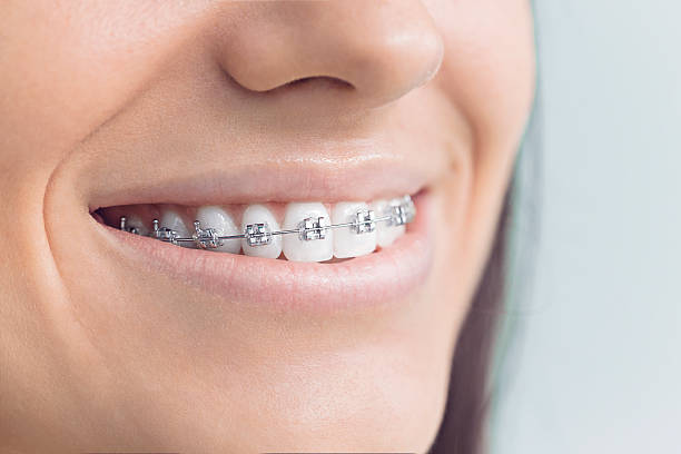 Full Mouth Reconstruction in Syracuse, IN